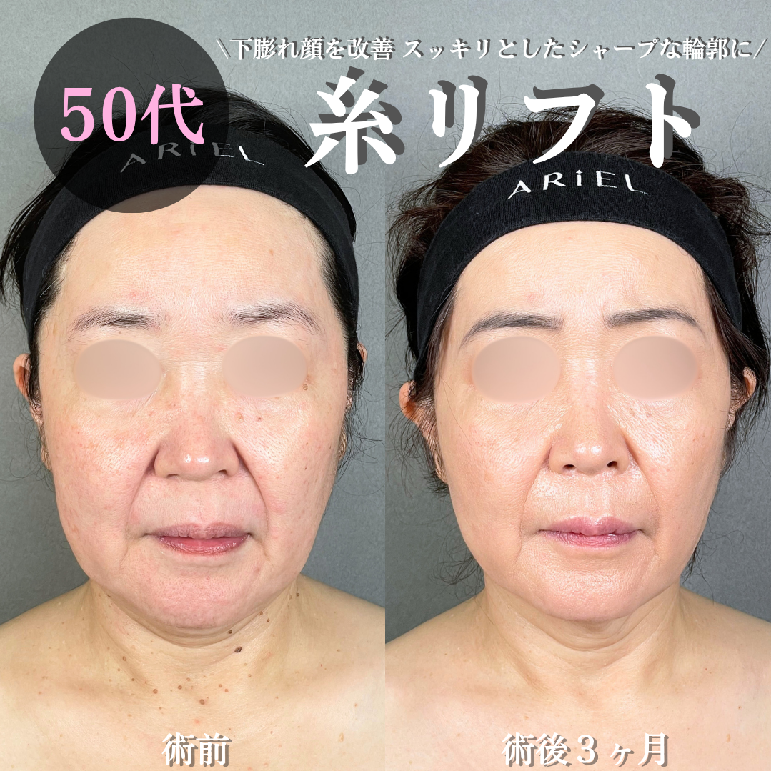No.21900の症例写真