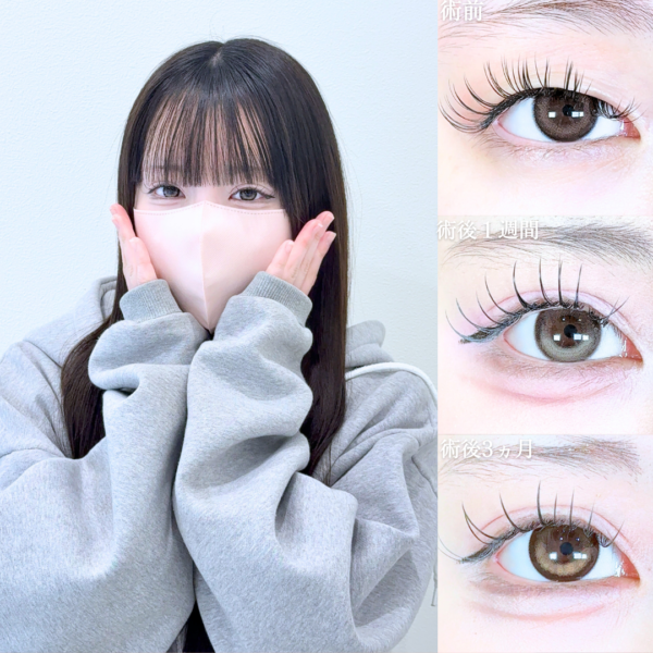 No.21189の症例写真