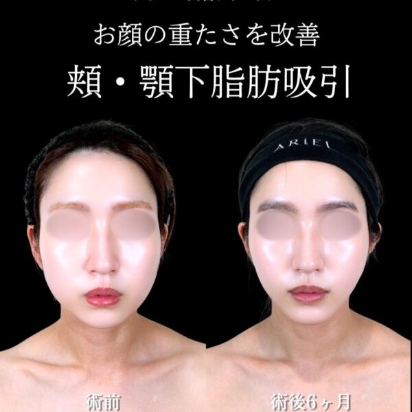 No.21540の症例写真