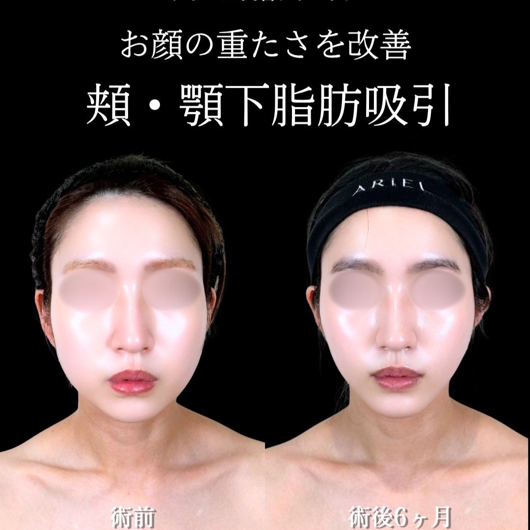No.21540の症例写真
