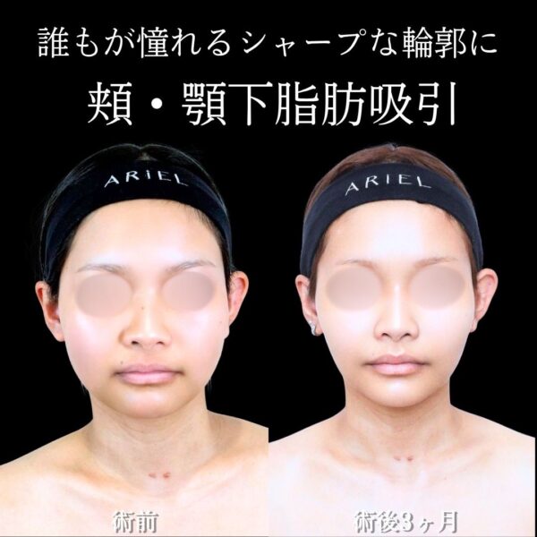 No.21594の症例写真