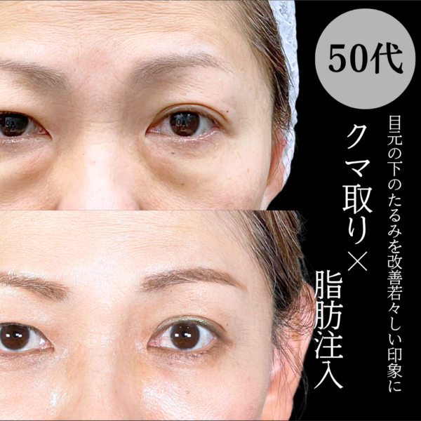 No.21209の症例写真