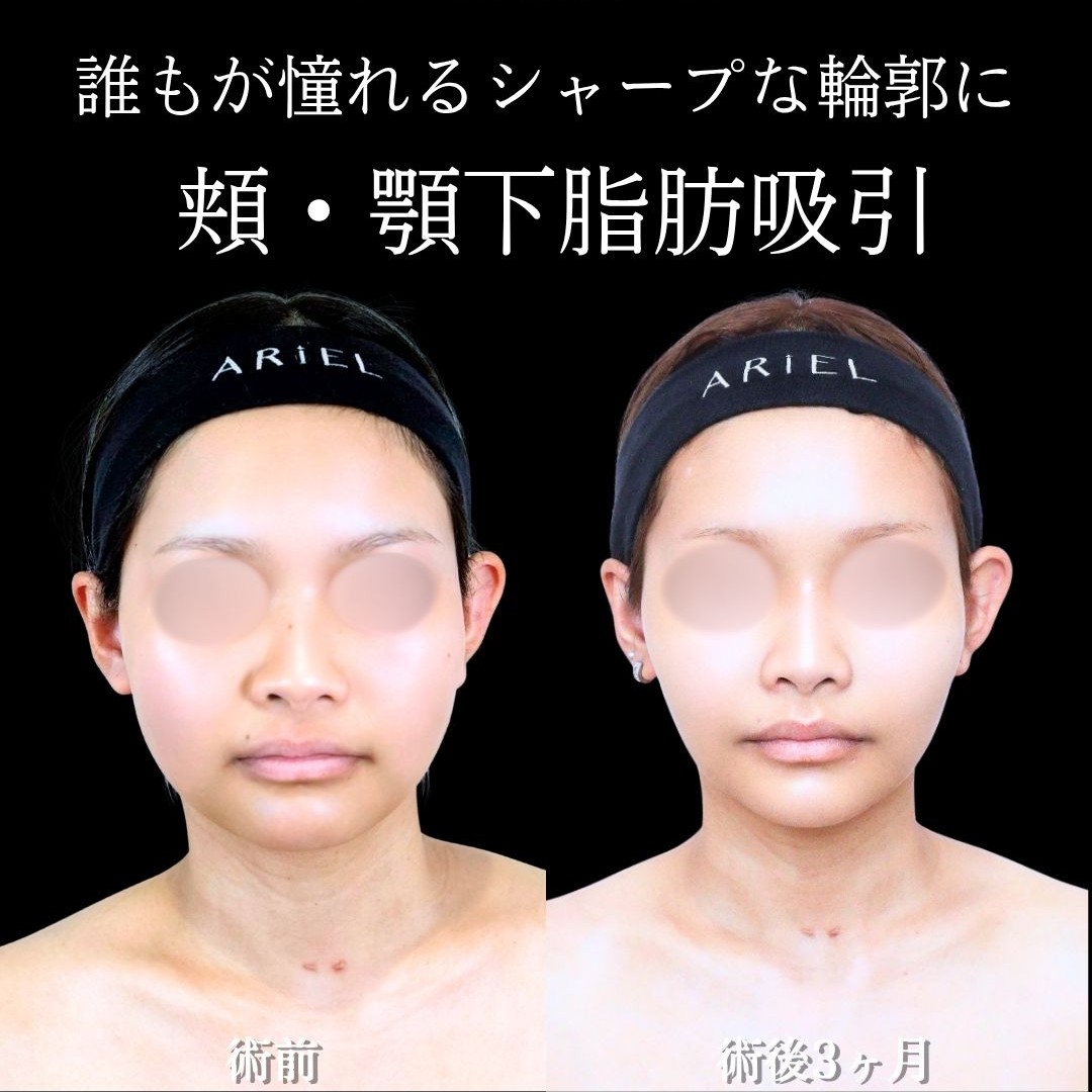 No.21594の症例写真