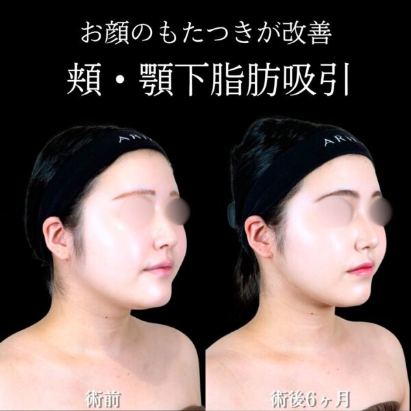 No.21945の症例写真