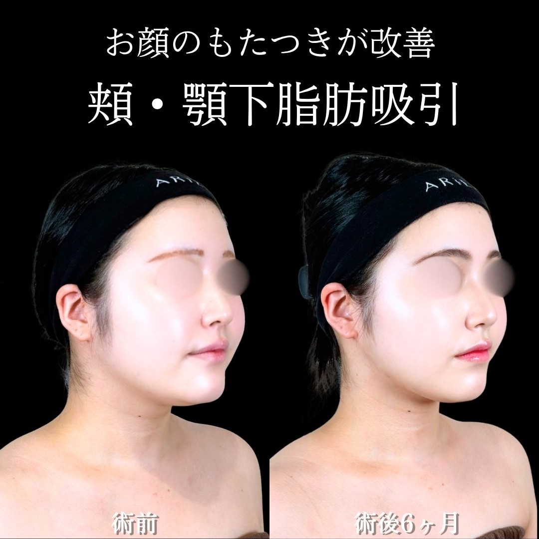 No.21945の症例写真
