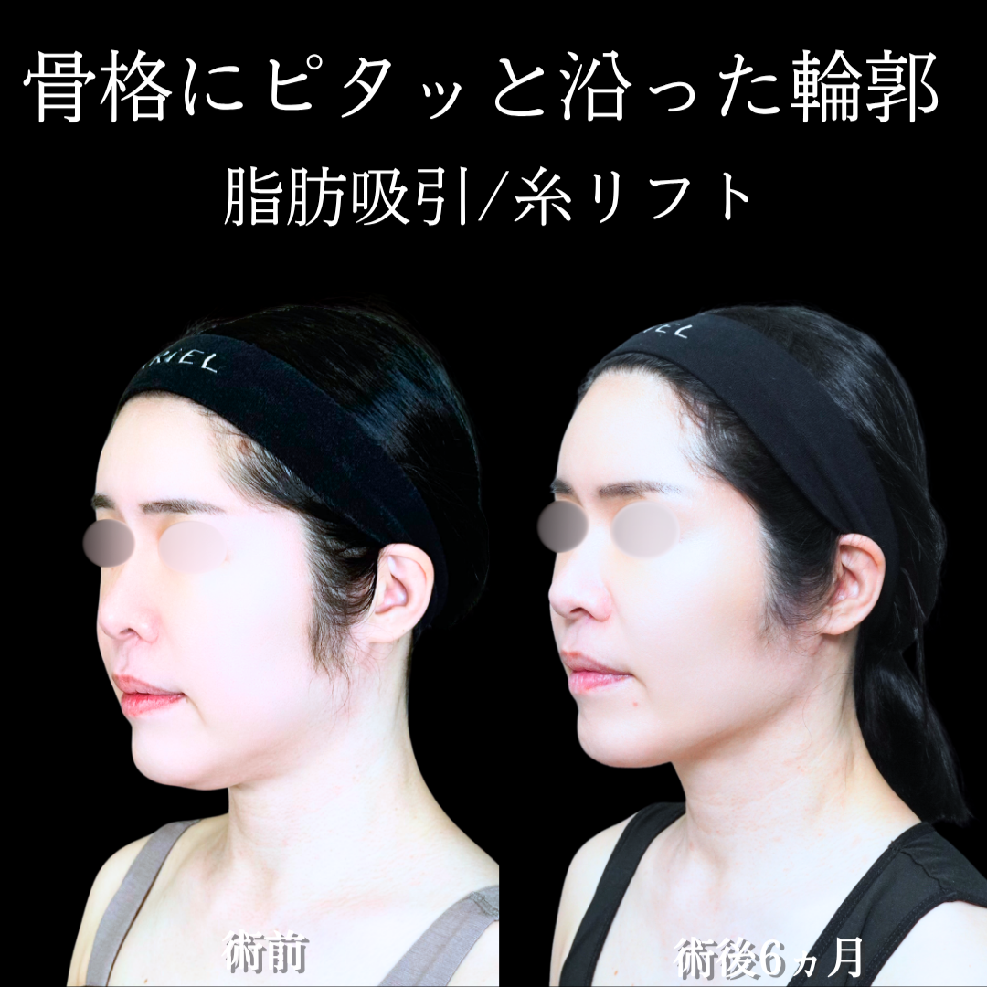 No.21253の症例写真