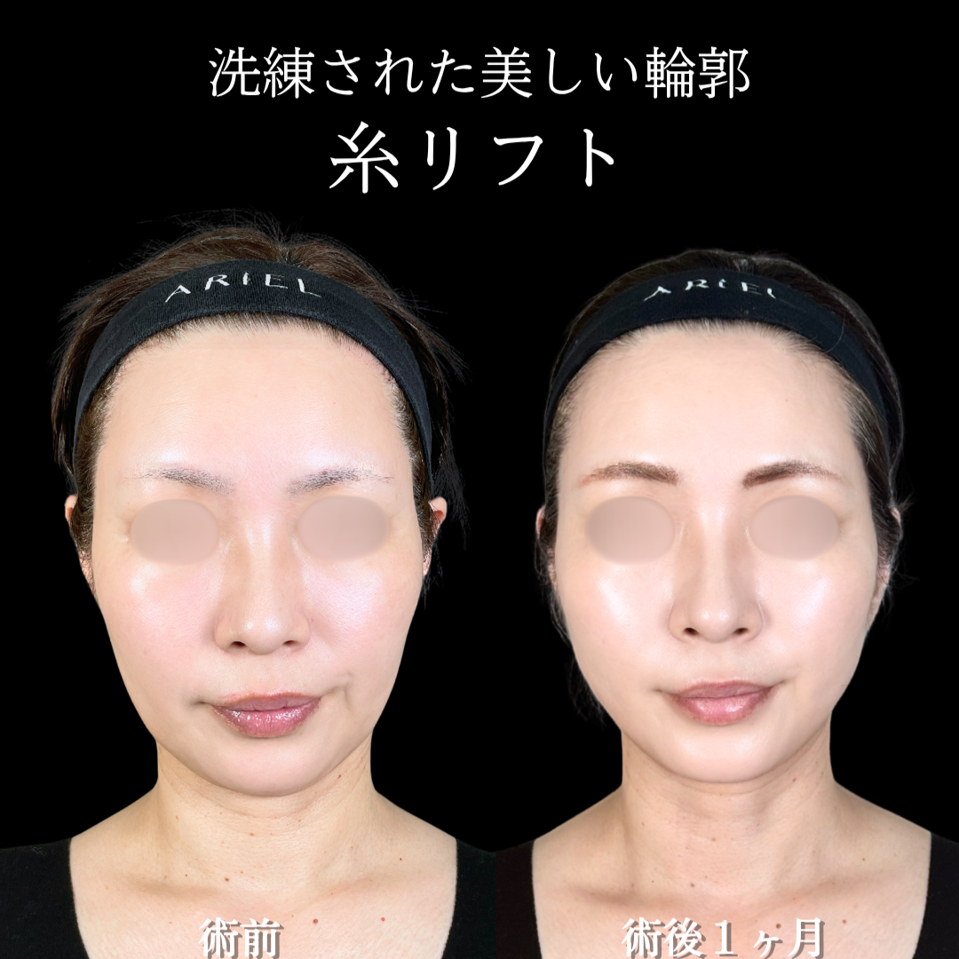 No.21260の症例写真