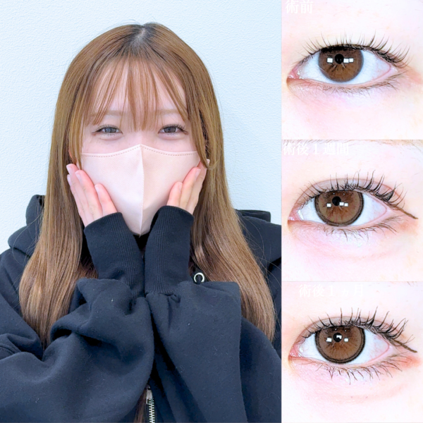 No.21278の症例写真