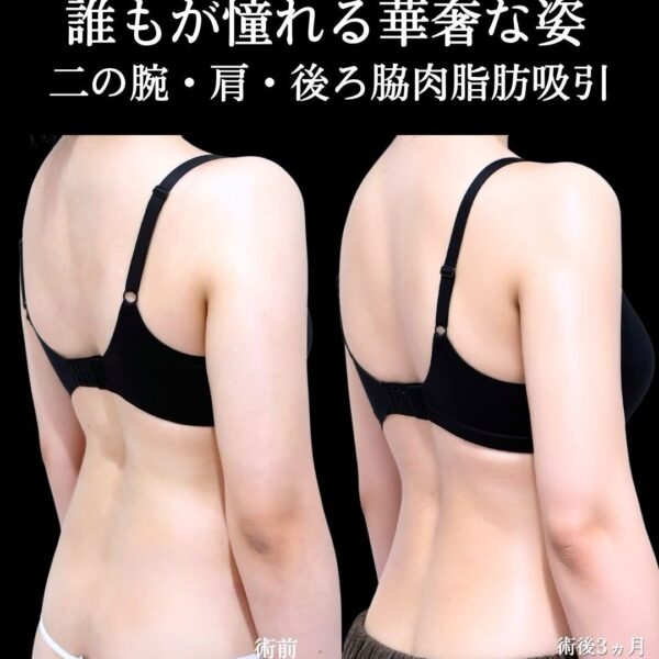 No.21216の症例写真