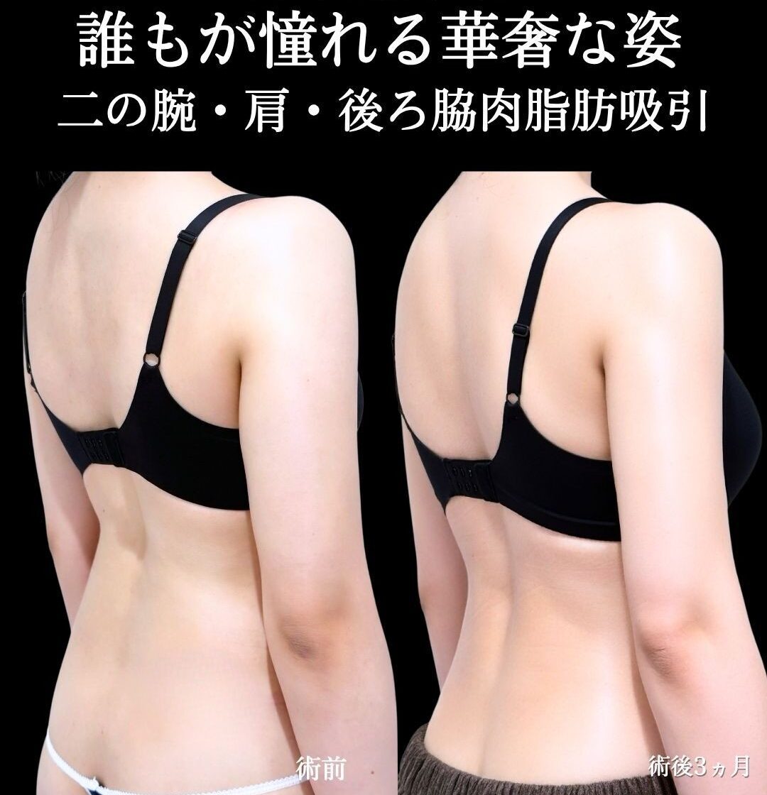 No.21216の症例写真
