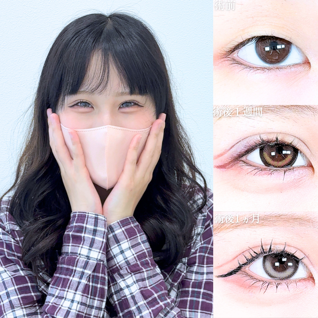 No.21141の症例写真
