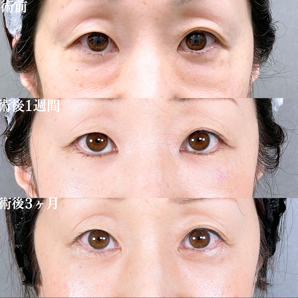 No.21147の症例写真1