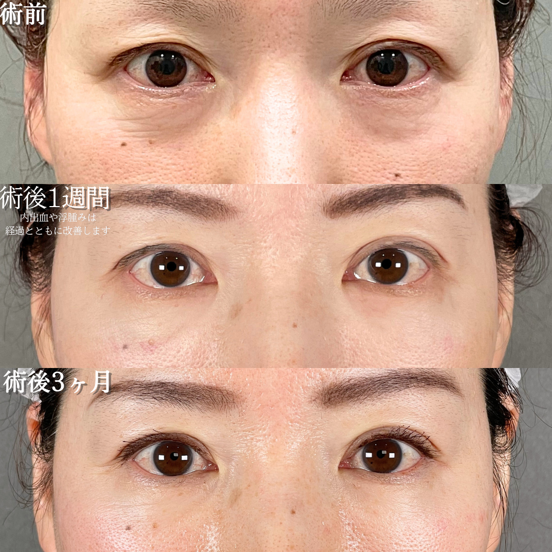 No.21290の症例写真1