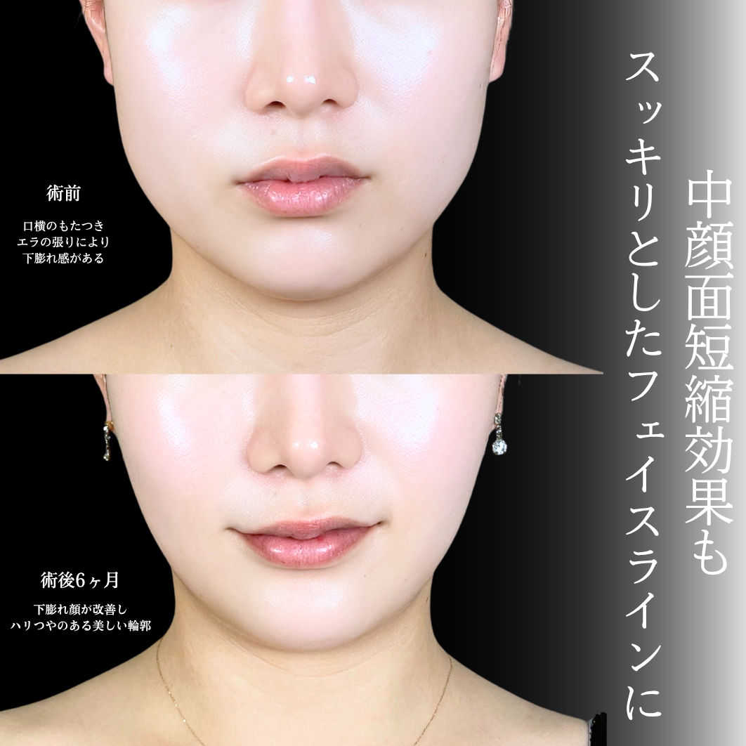 No.21380の症例写真1