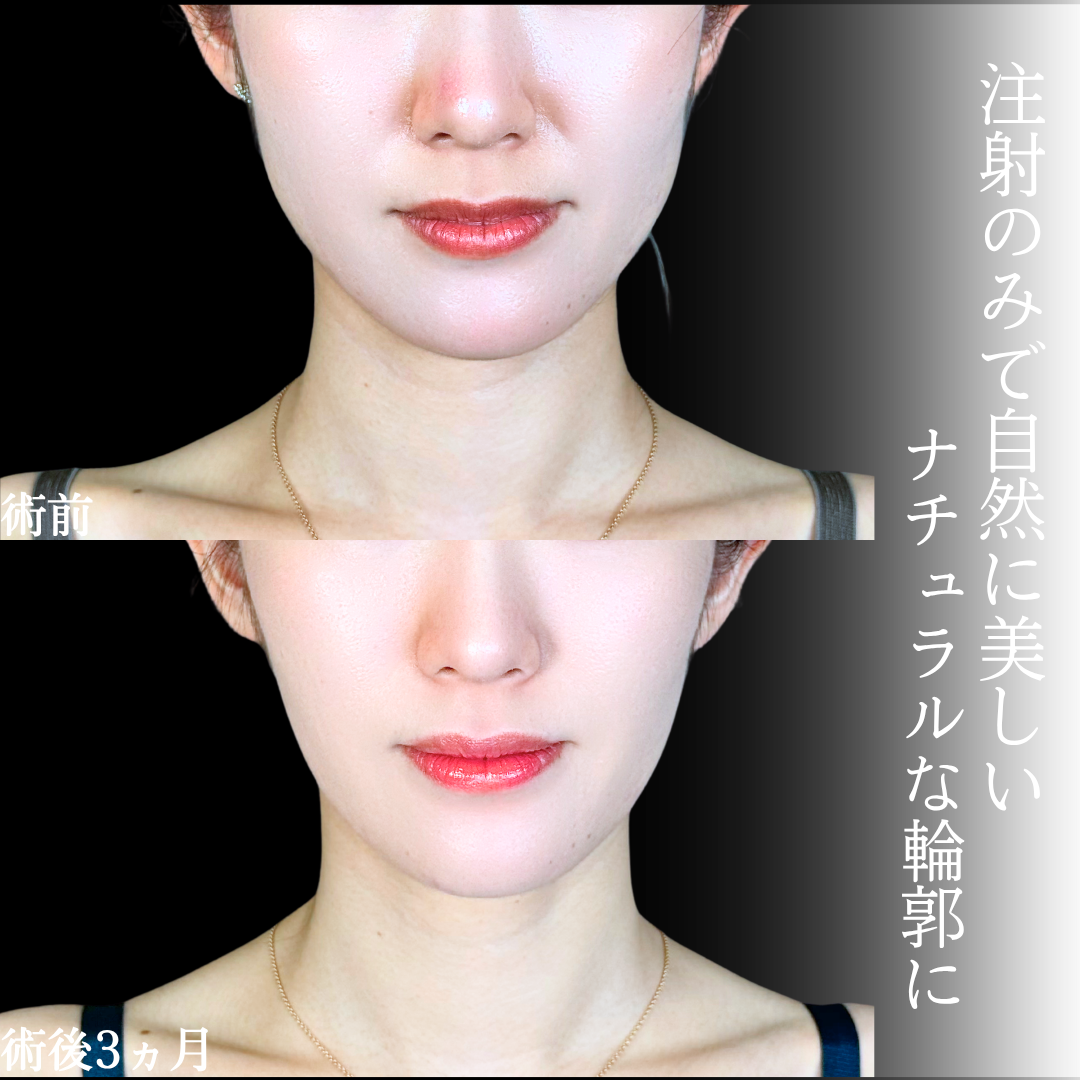 No.21463の症例写真1