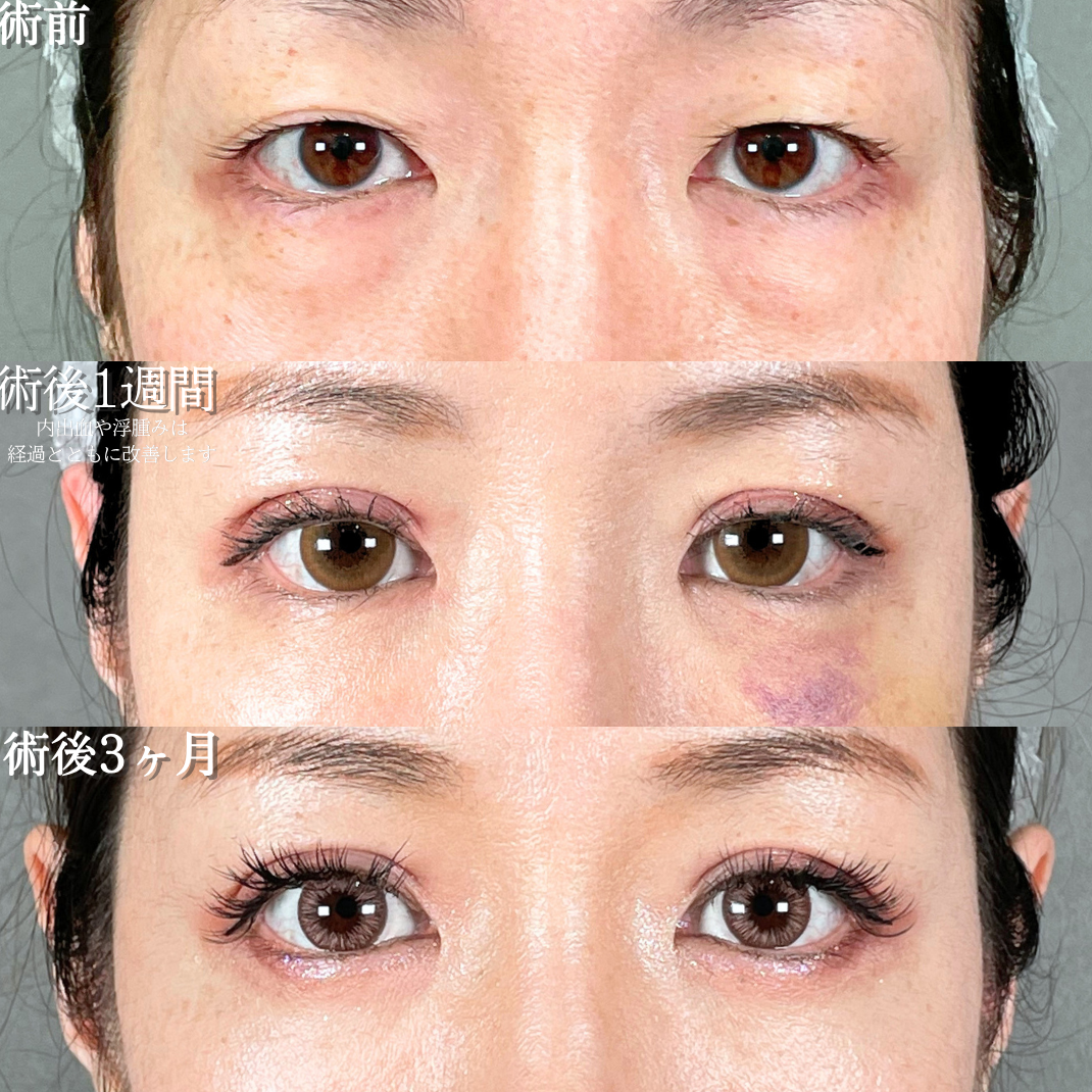 No.21507の症例写真1