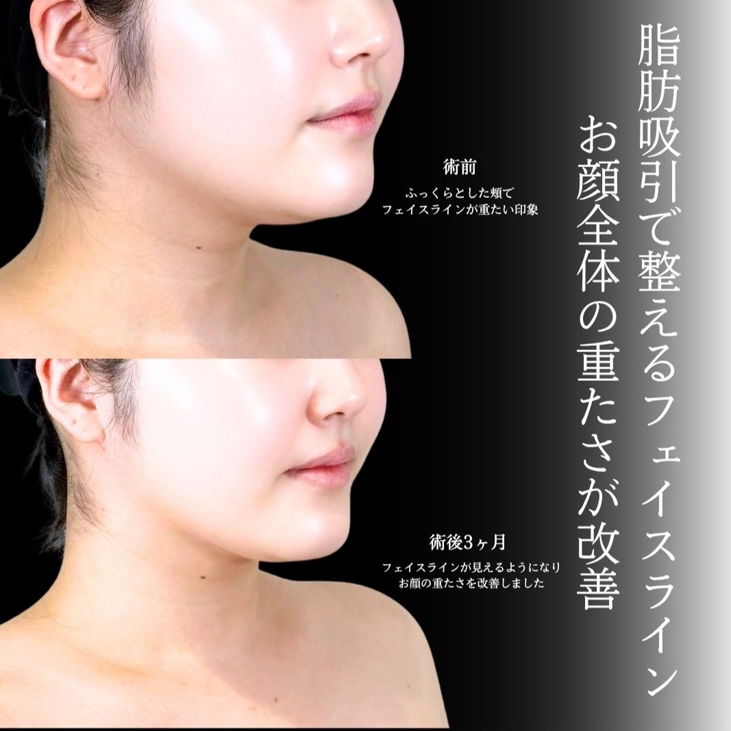 No.21244の症例写真1
