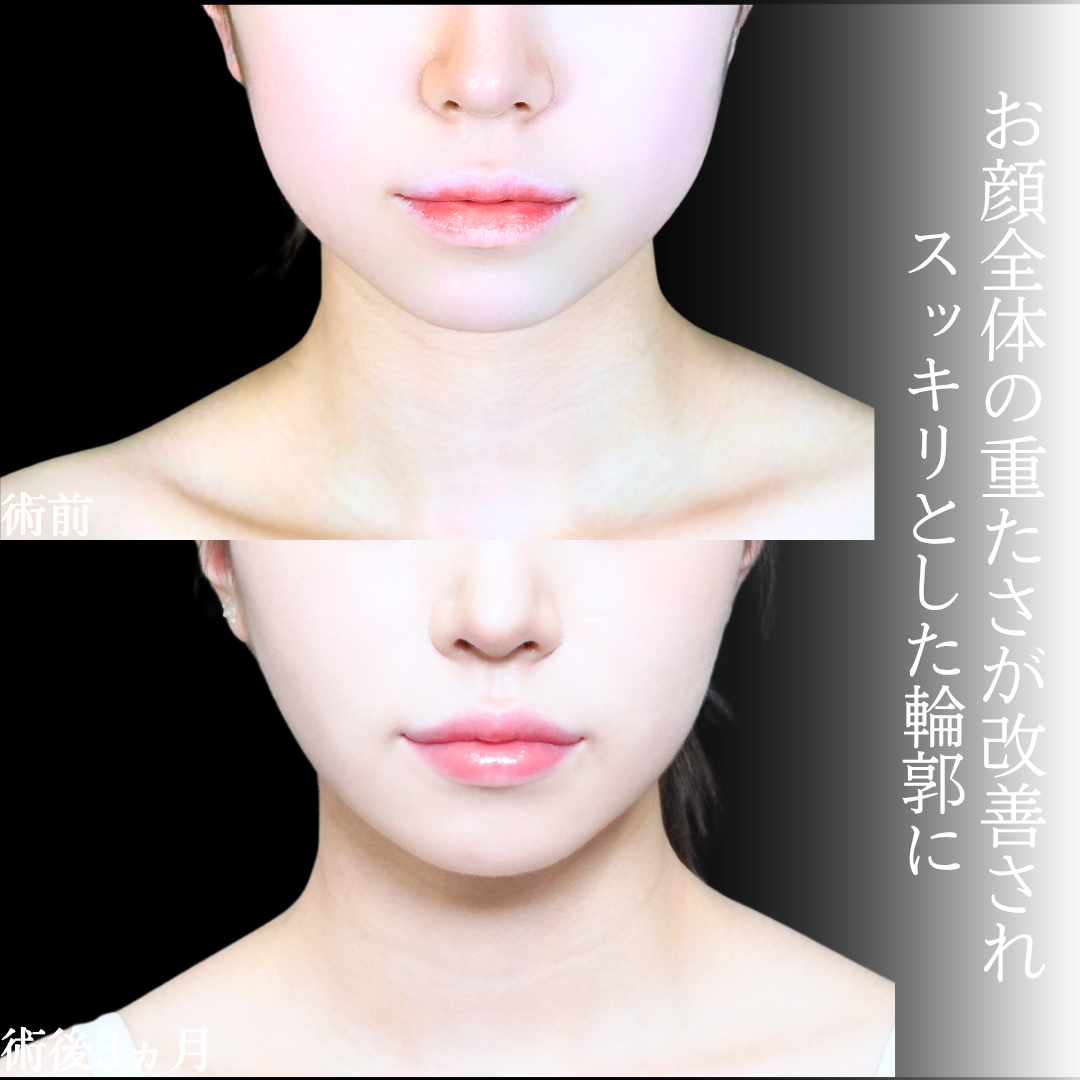 No.21161の症例写真1