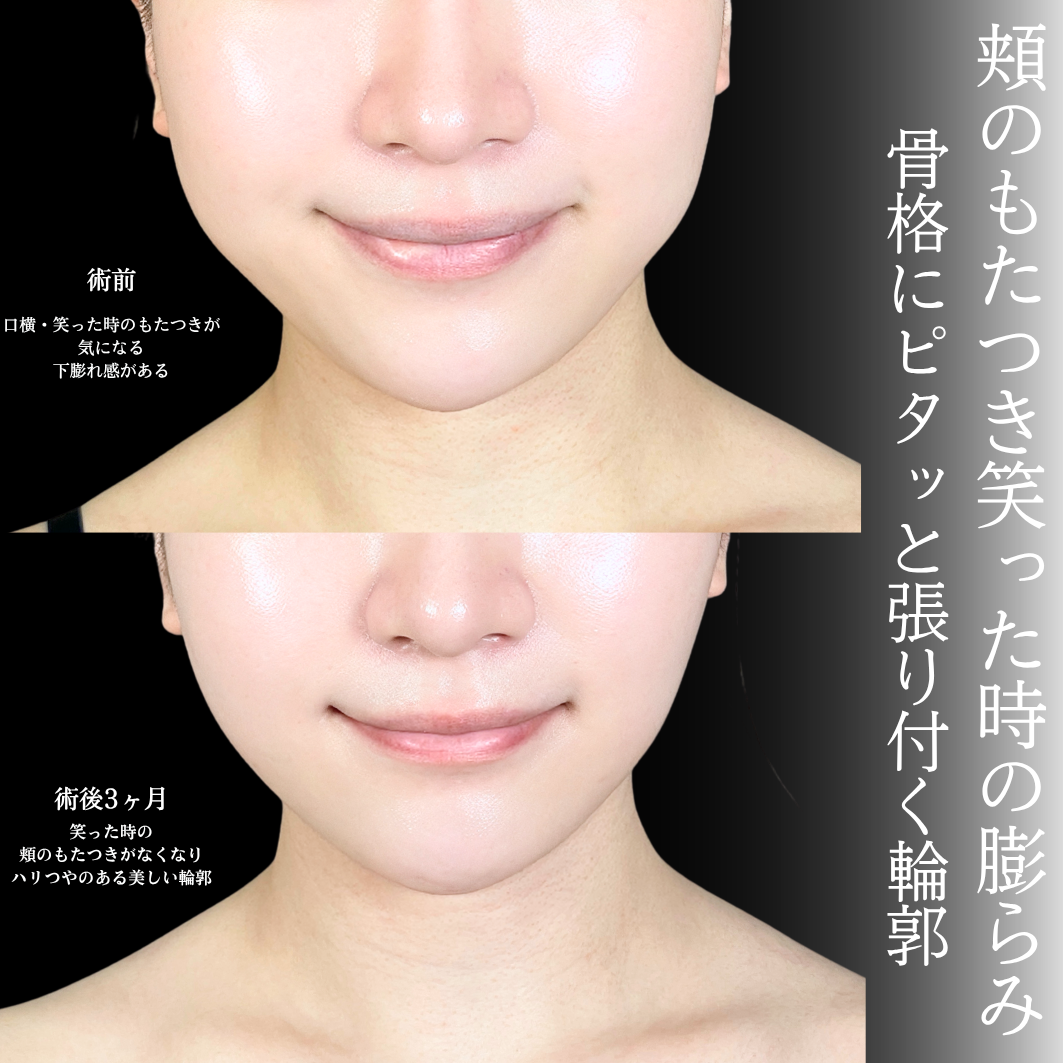 No.21572の症例写真1