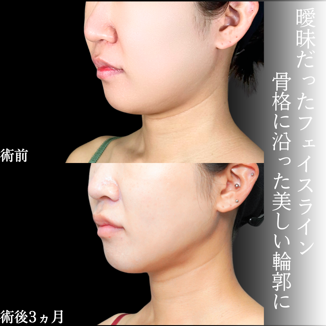 No.21792の症例写真1