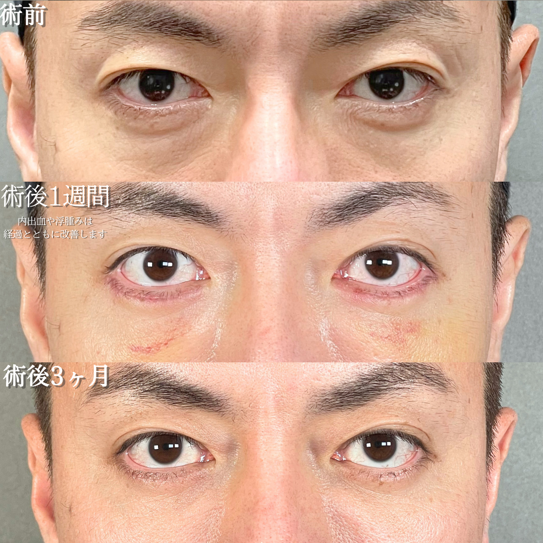 No.21832の症例写真1