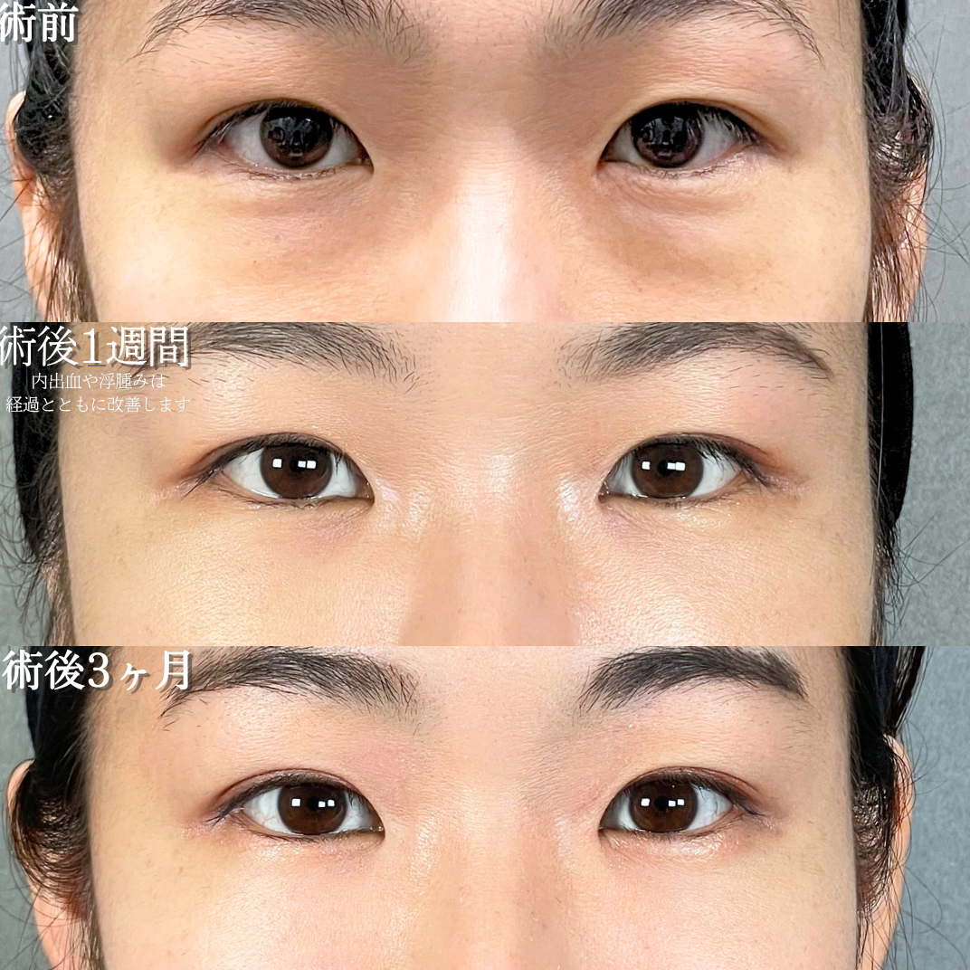 No.21168の症例写真1