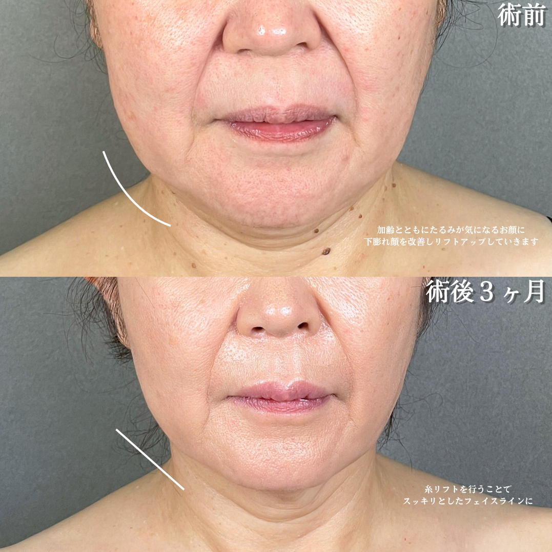No.21900の症例写真1
