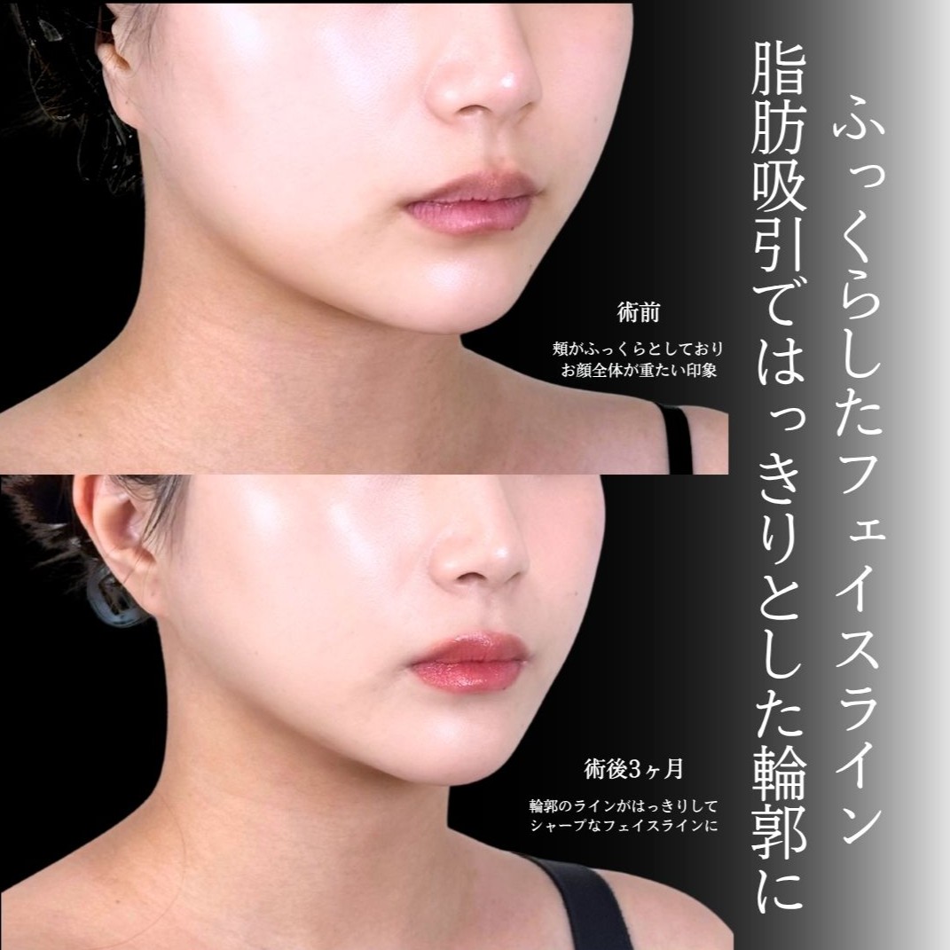 No.21435の症例写真1