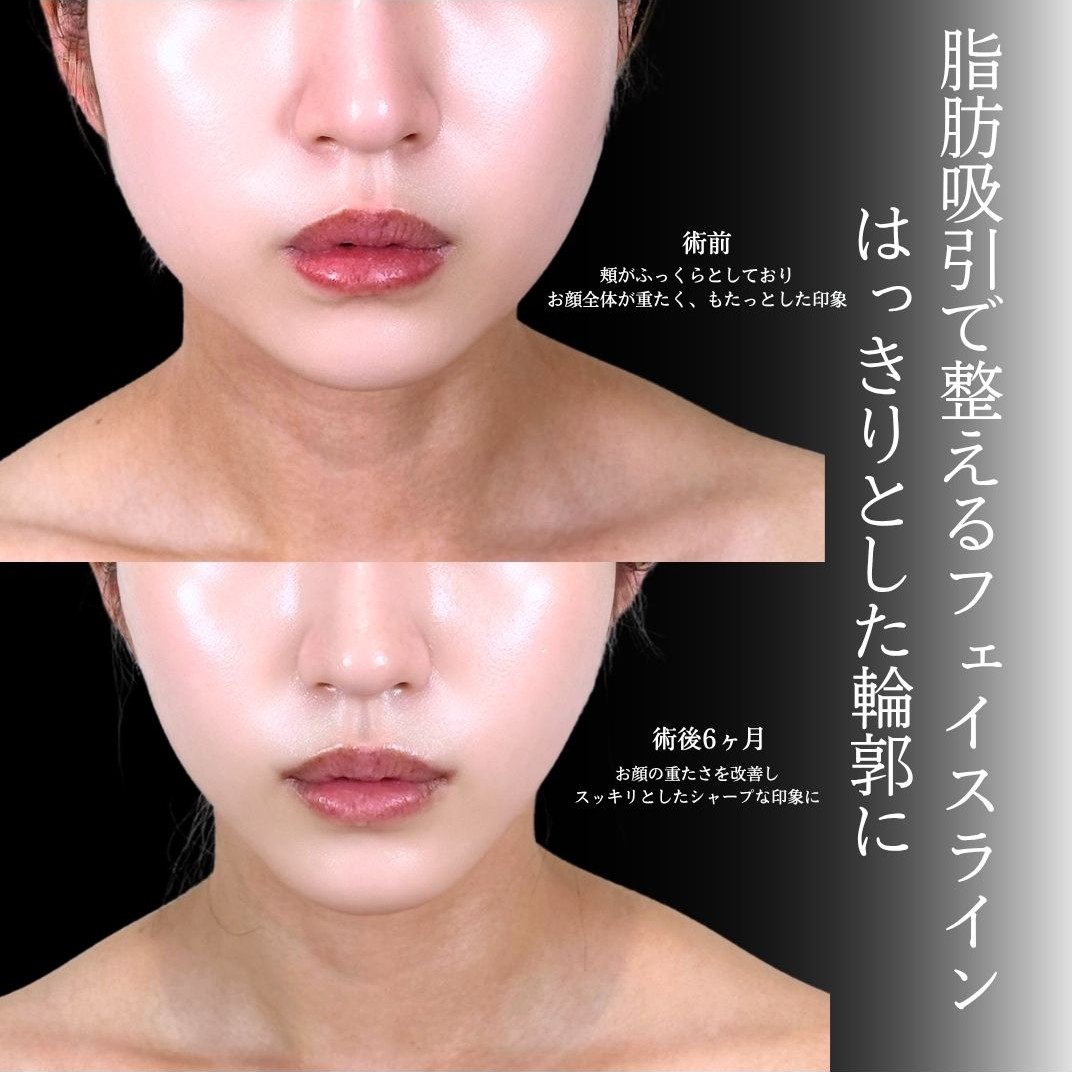 No.21540の症例写真1