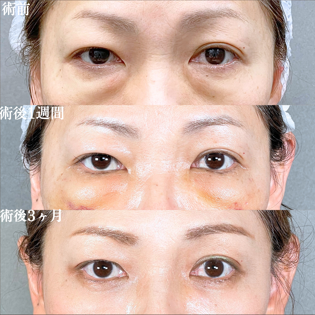 No.21209の症例写真1