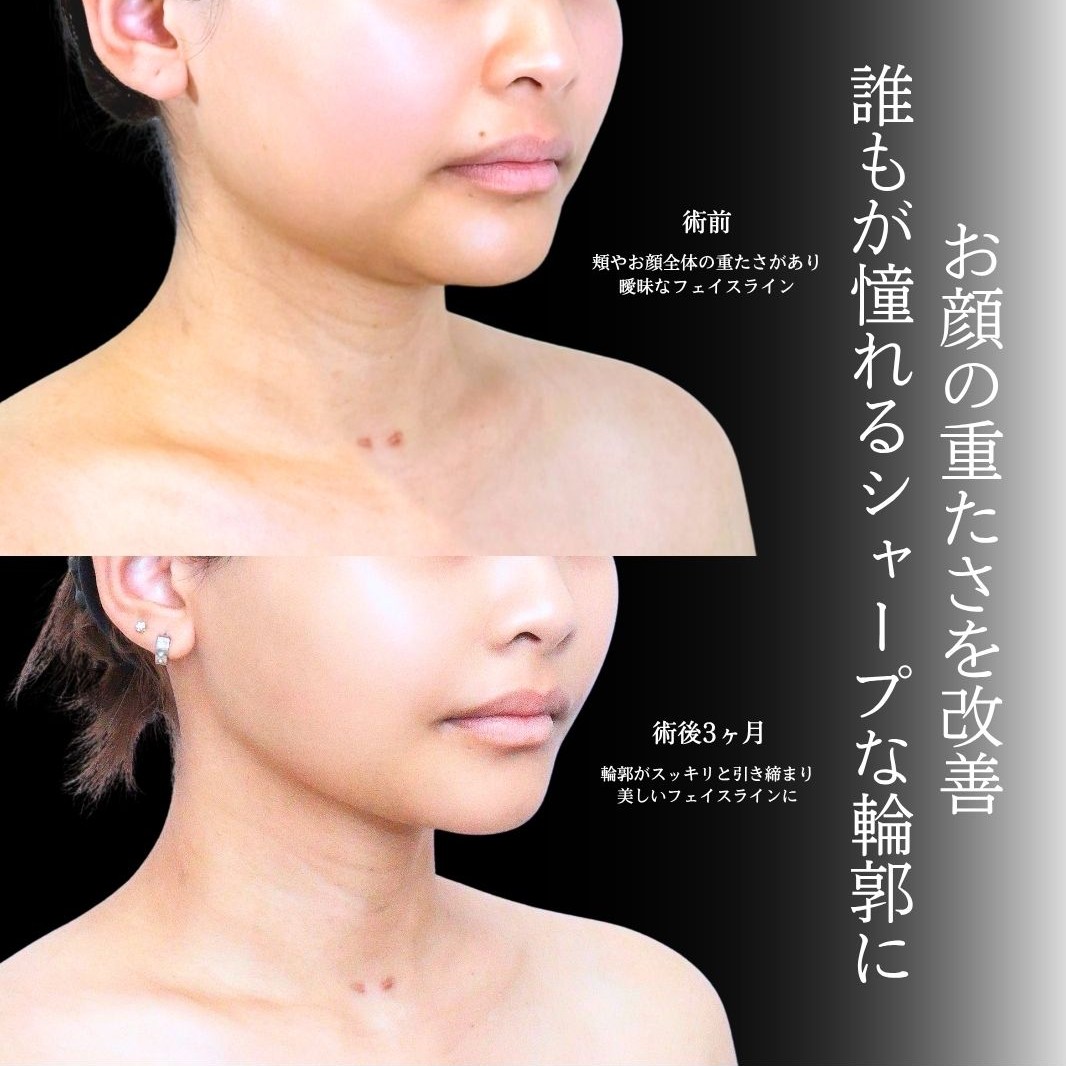 No.21594の症例写真1
