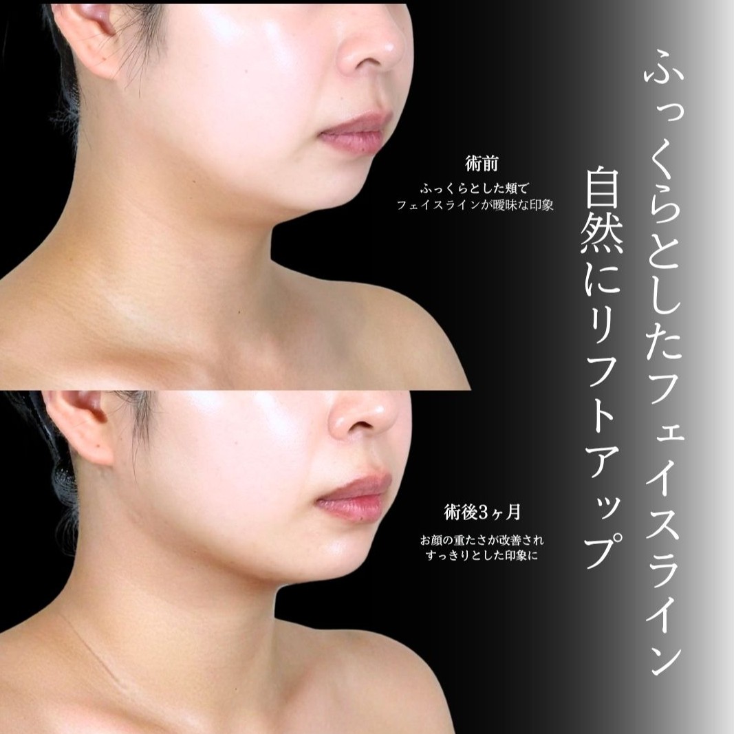 No.21699の症例写真1