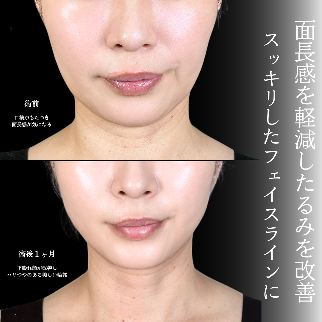 No.21260の症例写真1