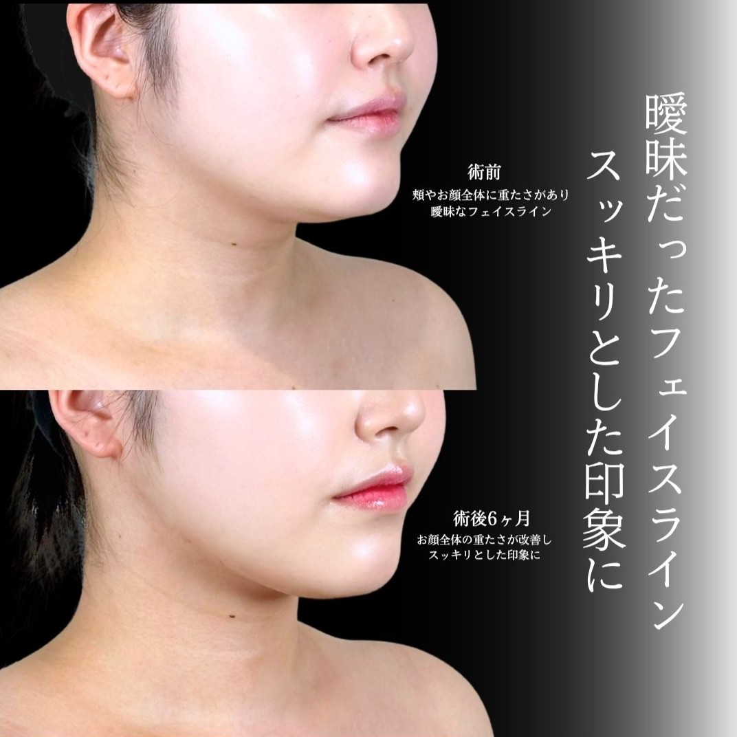 No.21945の症例写真1