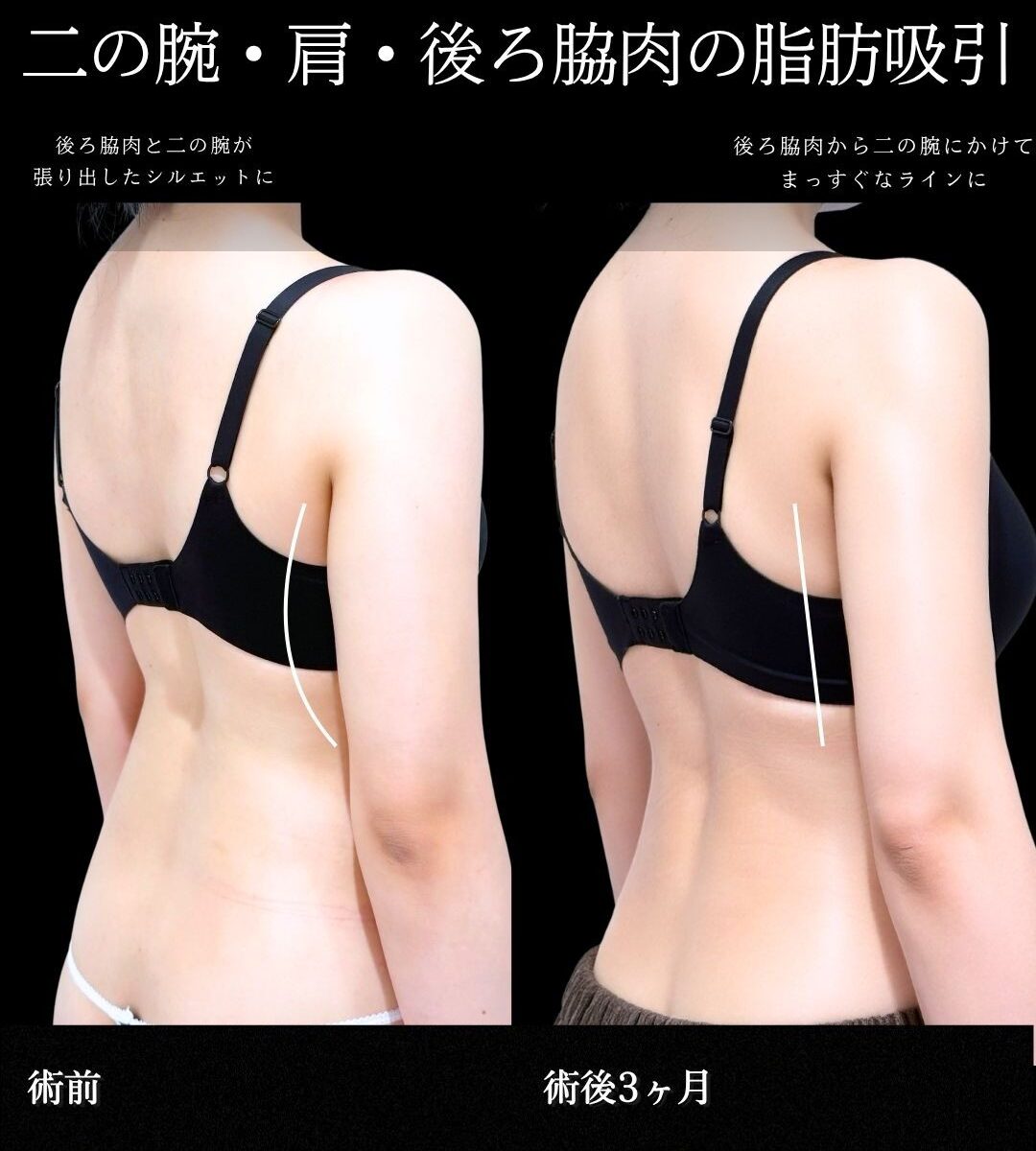 No.21216の症例写真1
