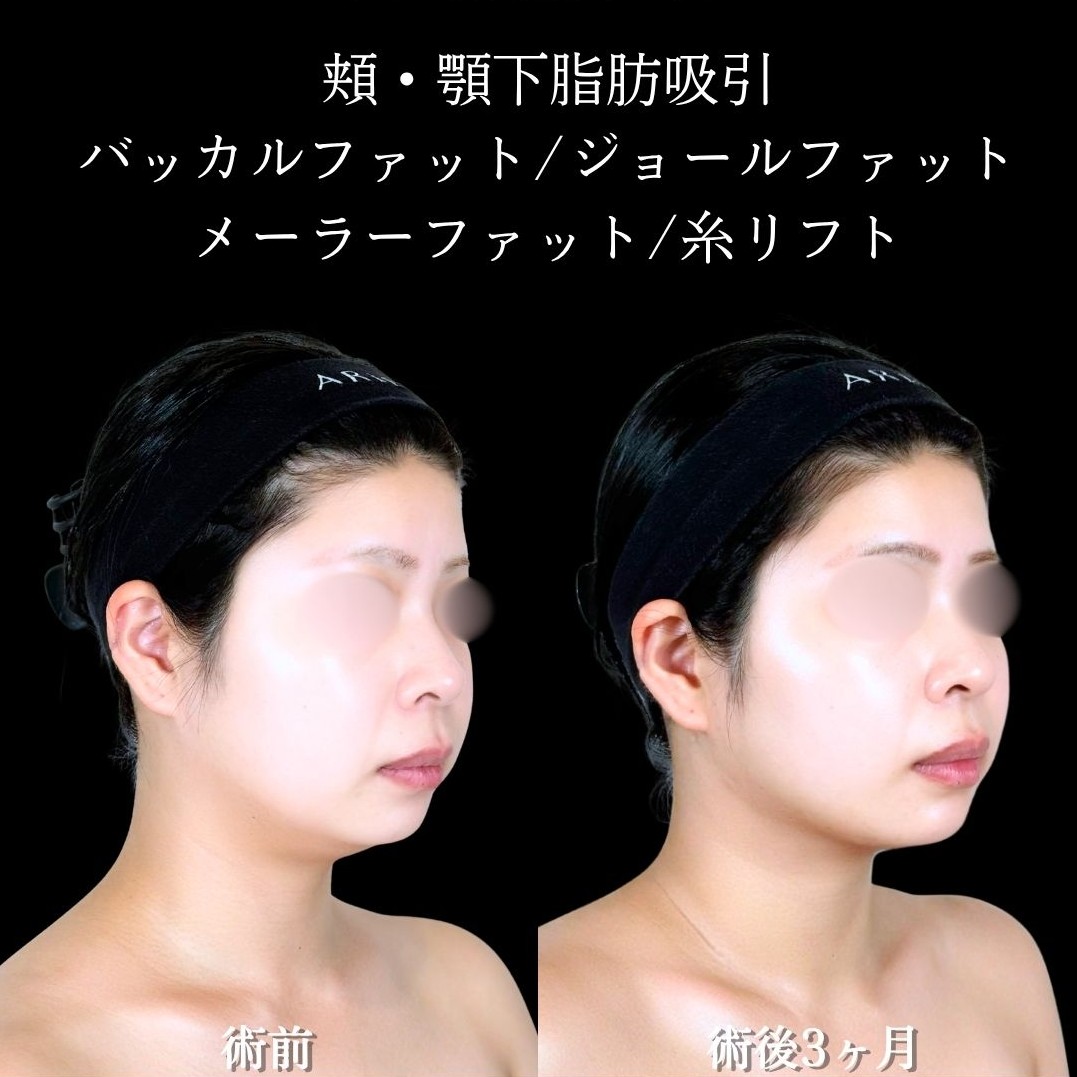 No.21699の症例写真