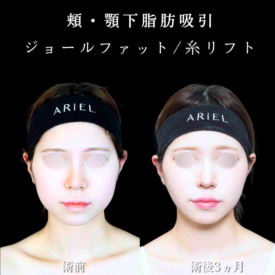No.21161の症例写真2