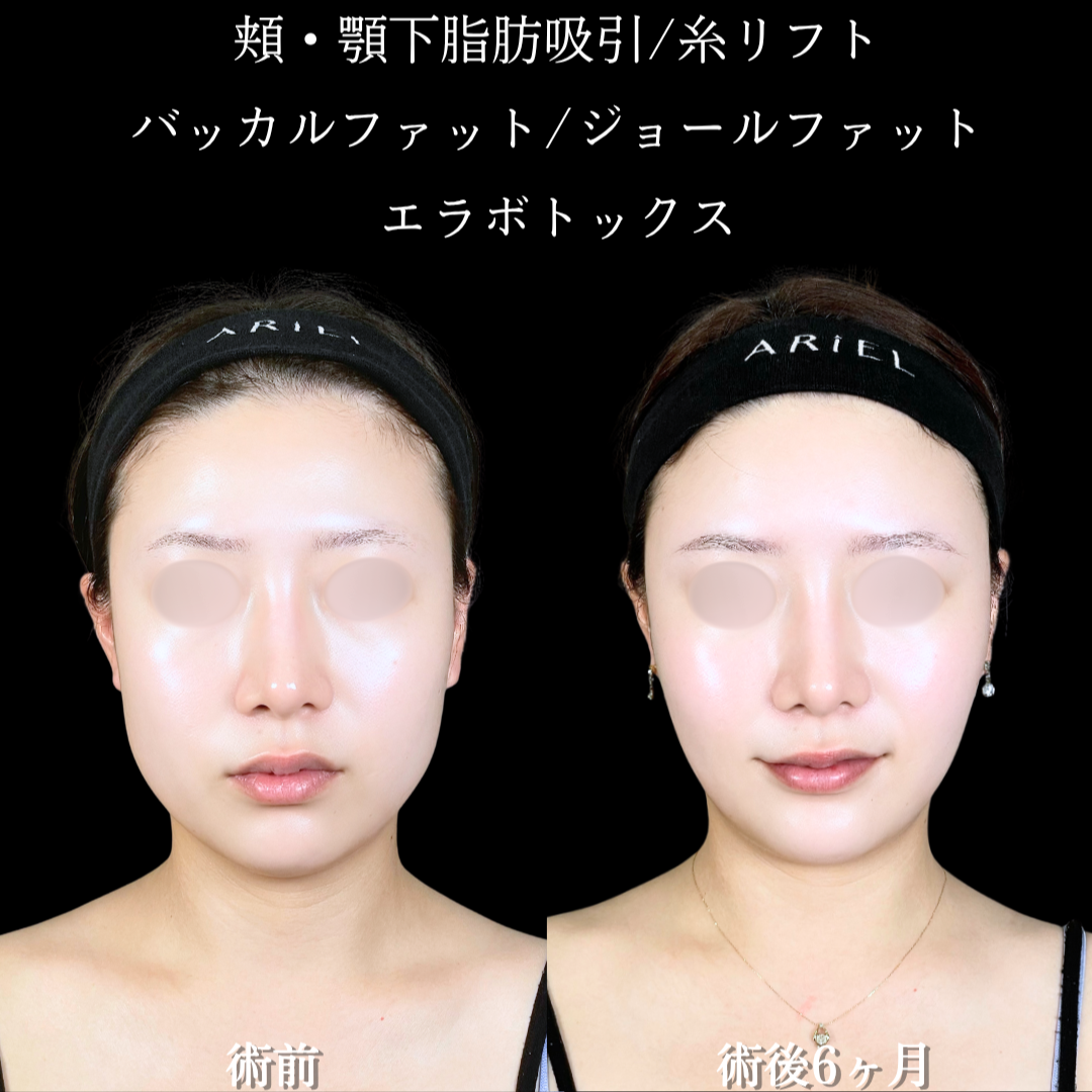 No.21380の症例写真2