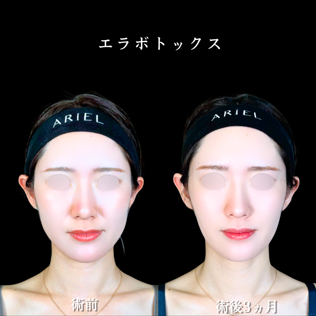 No.21463の症例写真2