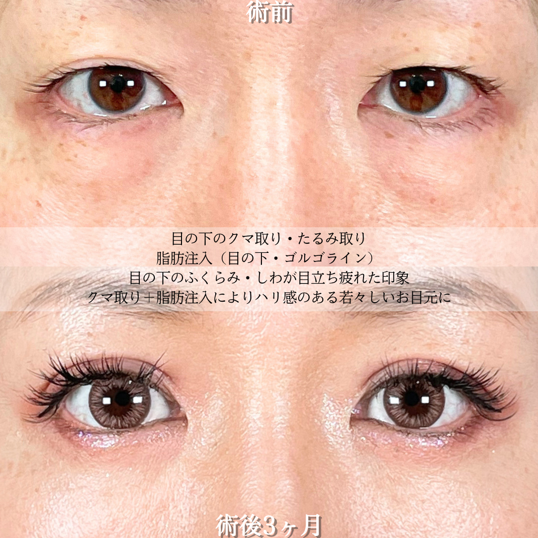 No.21507の症例写真2