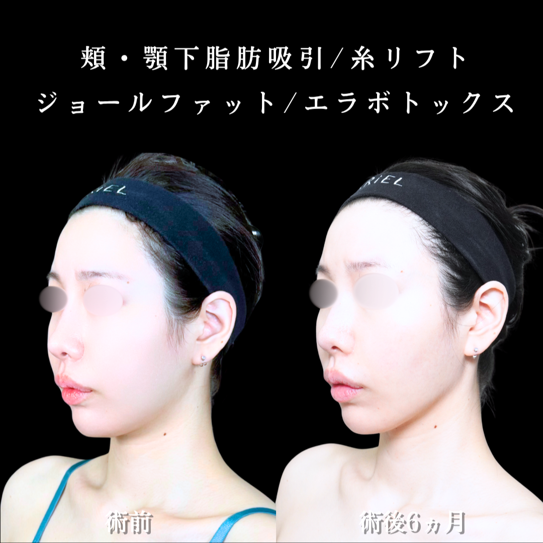 No.21581の症例写真2