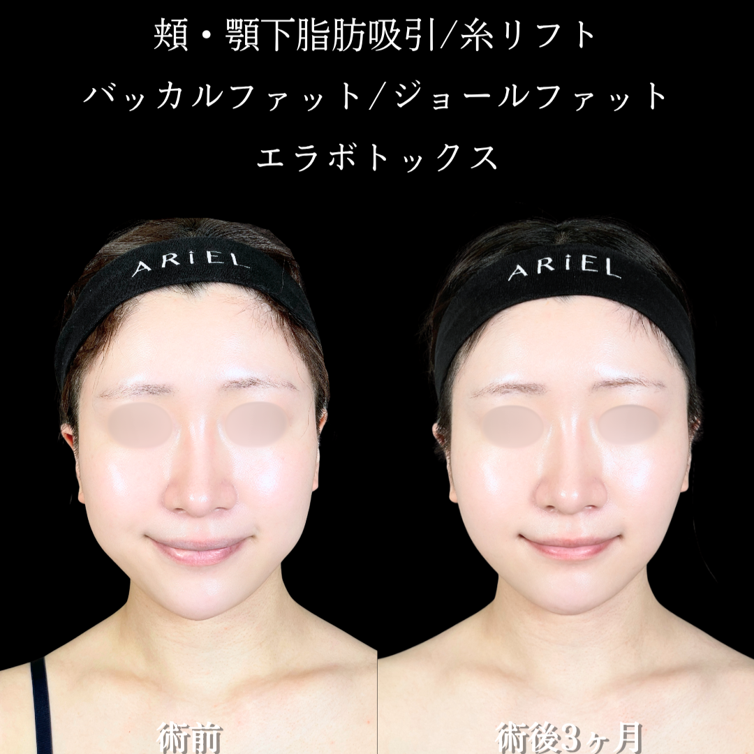 No.21572の症例写真2