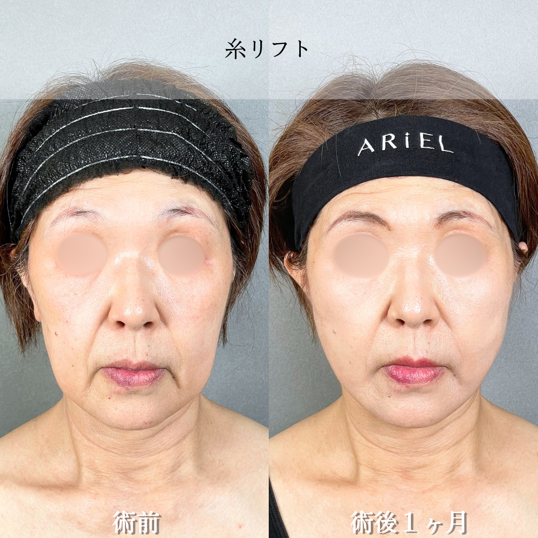 No.21686の症例写真2