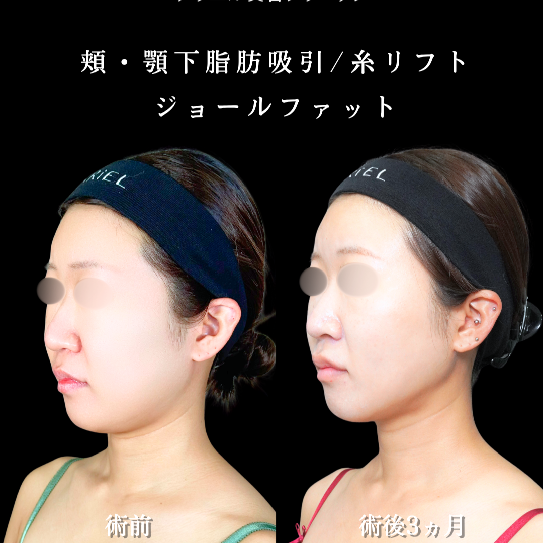 No.21792の症例写真2