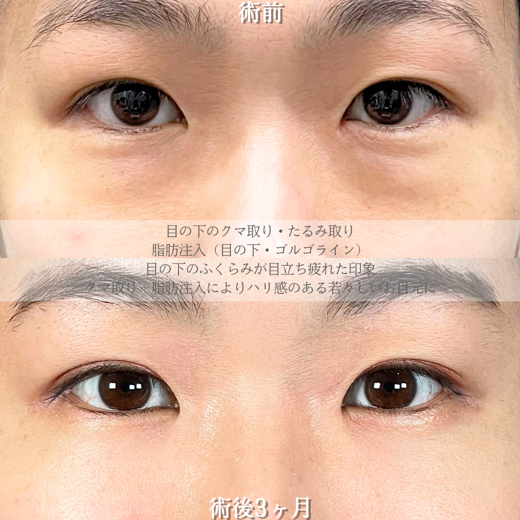 No.21168の症例写真2