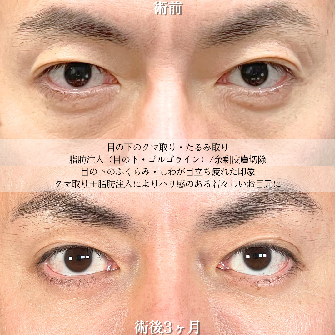 No.21832の症例写真2