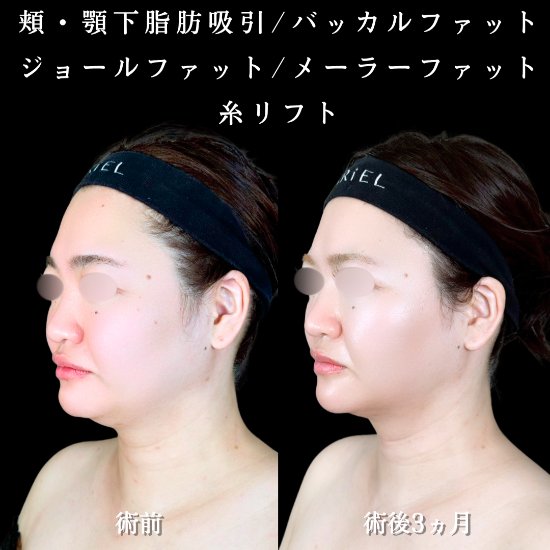 No.21865の症例写真2