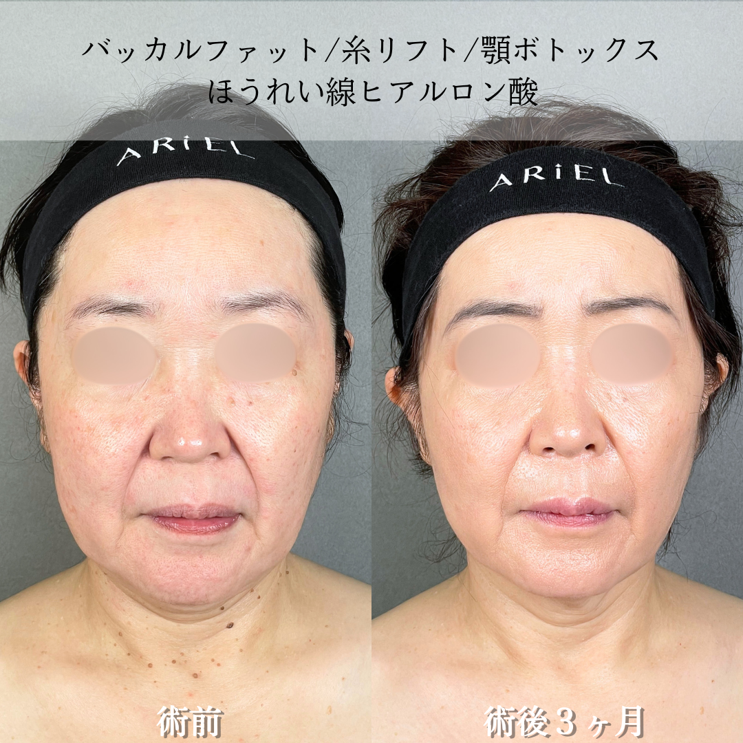 No.21900の症例写真2