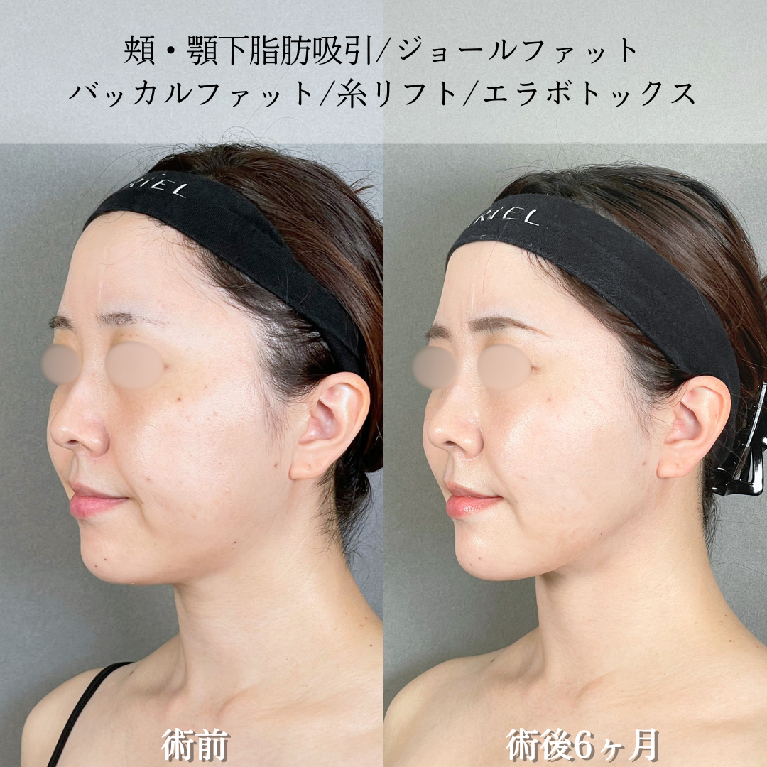 No.21182の症例写真2