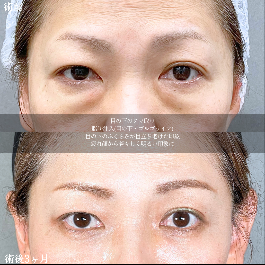 No.21209の症例写真2